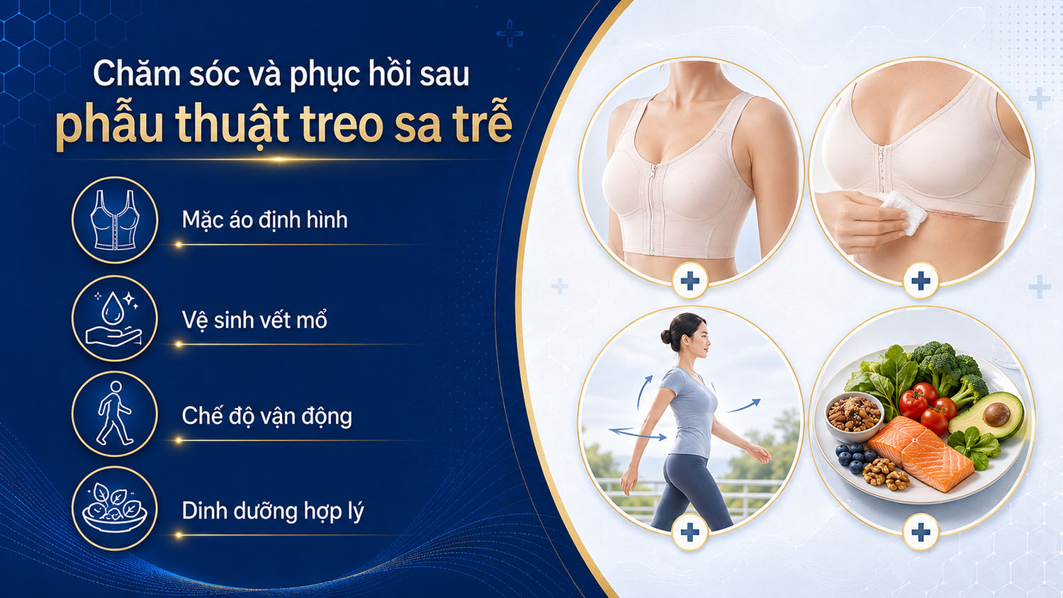 ảnh mô tả các Chăm sóc và phục hồi sau phẫu thuật treo sa trễ