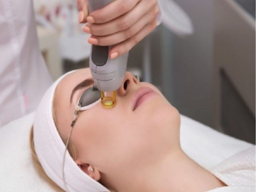 trị thâm mắt bằng Laser an toàn