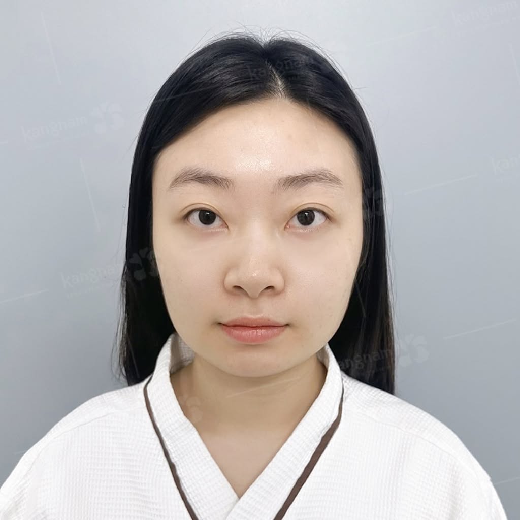 Yến Nhi sở hữu khuôn mặt to, góc hàm bạnh
