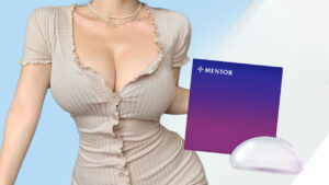 Túi Mentor không chip là gì? Ưu điểm và nhược điểm