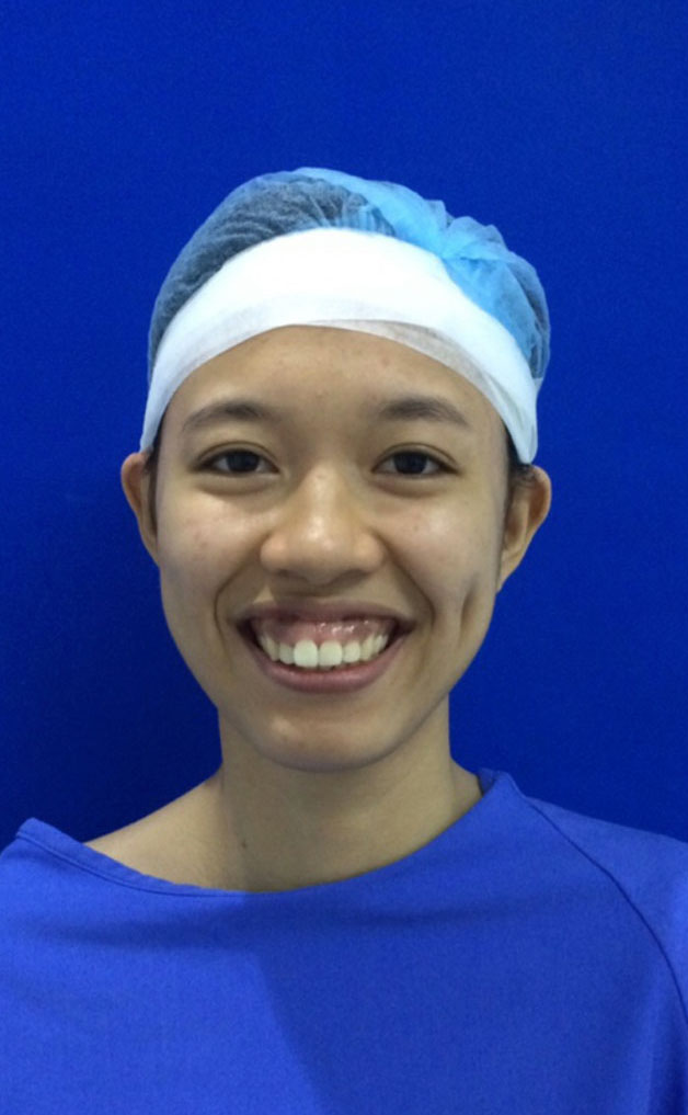 người bị cười hở nướu có thể ngại ngùng khi nói chuyện, cười đùa