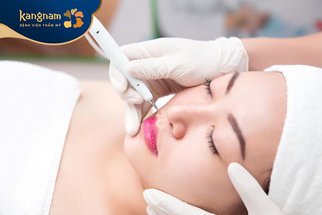 tẩy nốt ruồi bằng tia Laser CO2 Fractional