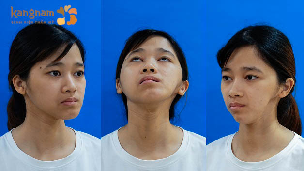 Tình trạng Thu Hường khá nghiêm trọng và hiếm gặp