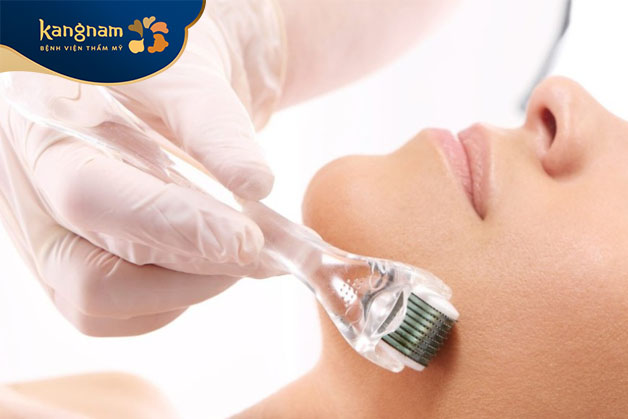 Các đầu kim tạo lỗ nhỏ trên bề mặt da, kích thích tái tạo tế bào