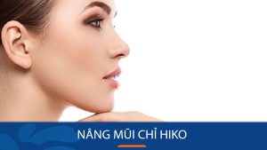 Nâng mũi bằng chỉ Hiko là gì? Quy trình, ưu điểm và giá cả chi tiết