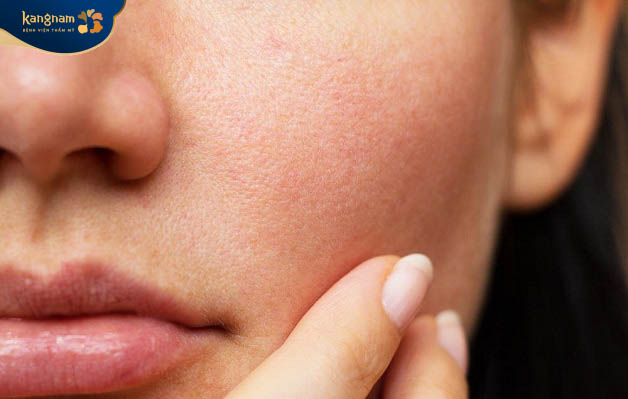 Làn da khô ráp, bong tróc nếu ứng dụng sai cách