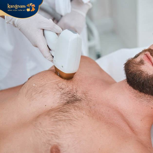 Ứng dụng tẩy lông bằng tia laser