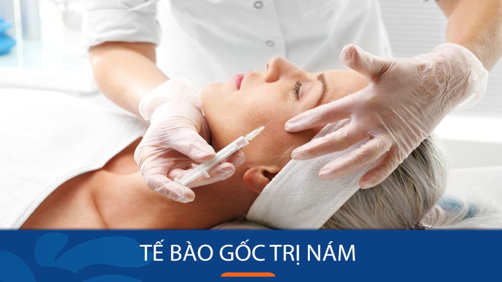Tế bào gốc trị nám là gì? 5 phương pháp trị nám dứt điểm hiện nay