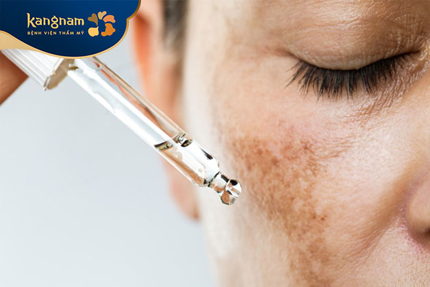 Tế bào gốc điều trị nám có 2 loại chính là: Tế bào gốc tự thân và chế phẩm từ tế bào gốc.