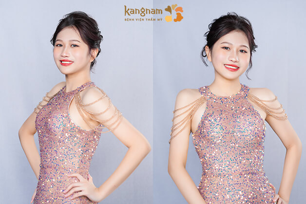 Sự thay đổi ngoạn mục của Xuân Mai sau khi “lột xác” thành công