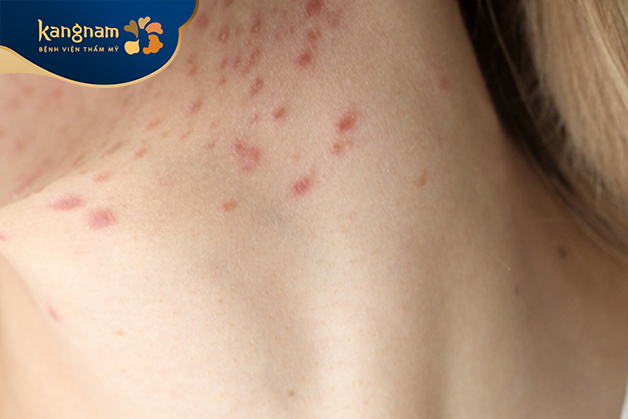 Do tóc và quần áo cọ xát liên tục