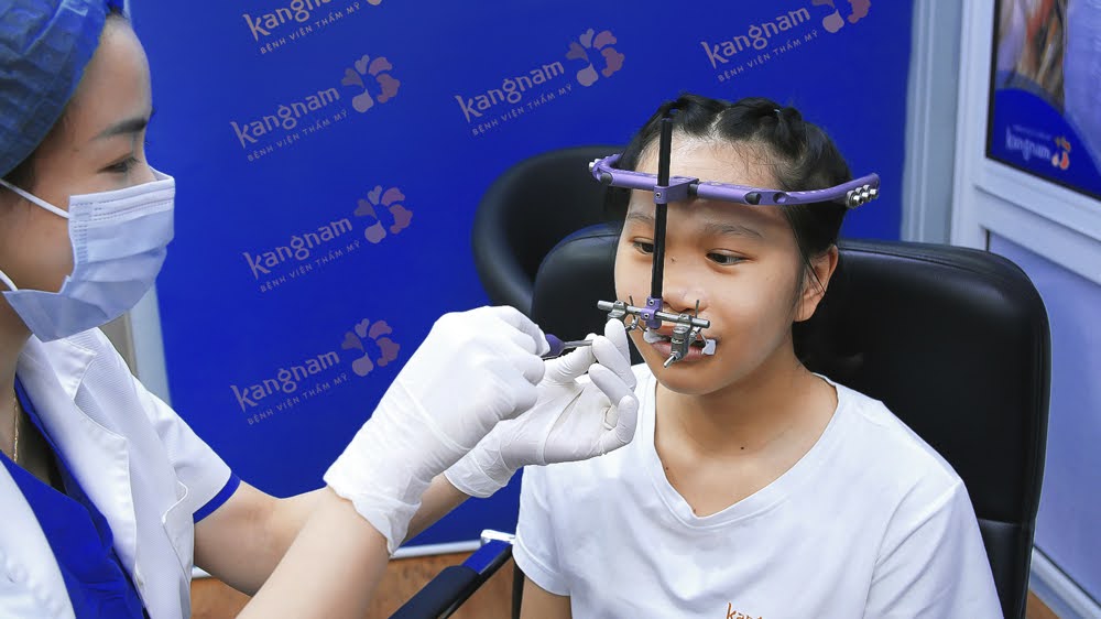 Xuân Mai kéo giãn xương hàm liên tục trong 1 tháng