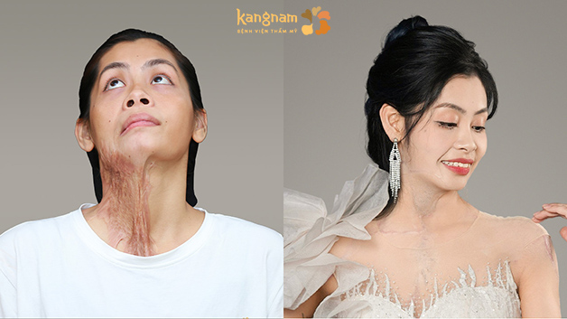 Diệu Linh tỏa sáng sau 6 tháng tham gia Hành trình Lột xác, tự tin với diện mạo mới