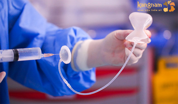 Túi giãn da được sử dụng để tạo thể tích da 