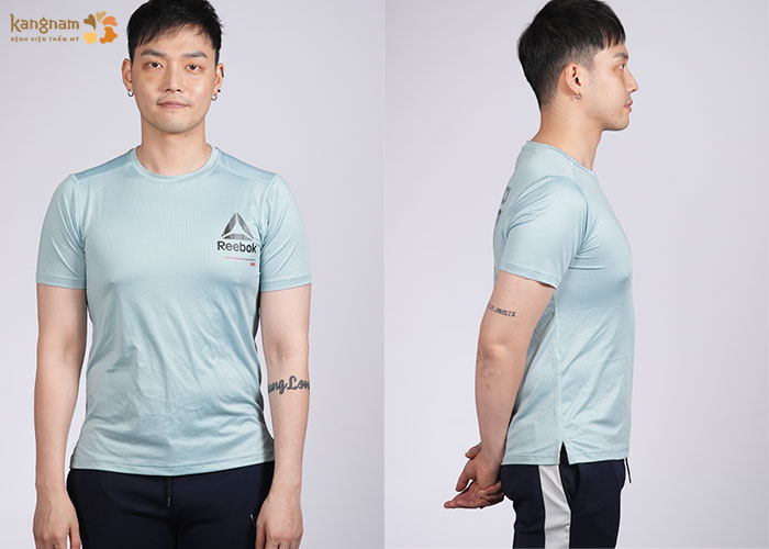 Body của anh Thủng Long trước khi “trùng tu”