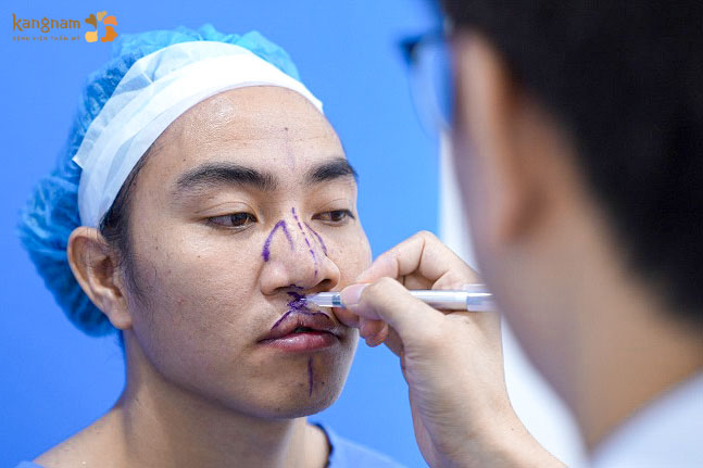 Bác sĩ đánh dấu vị trí cần phẫu thuật