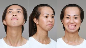 Cô gái 9X tạm dừng ước mơ làm giáo viên vì mặc cảm ngoại hình