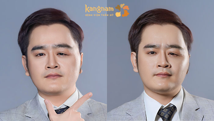 Diện mạo mới tỏa sáng của Thanh Hưng sau khi được ekip bác sĩ loại bỏ khối u