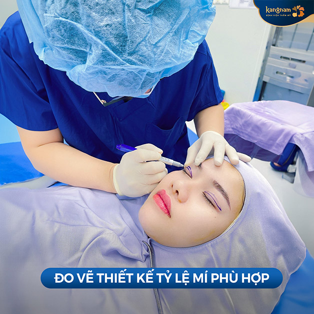 Đo vẽ mí mắt trước khi thực hiện tiểu phẫu