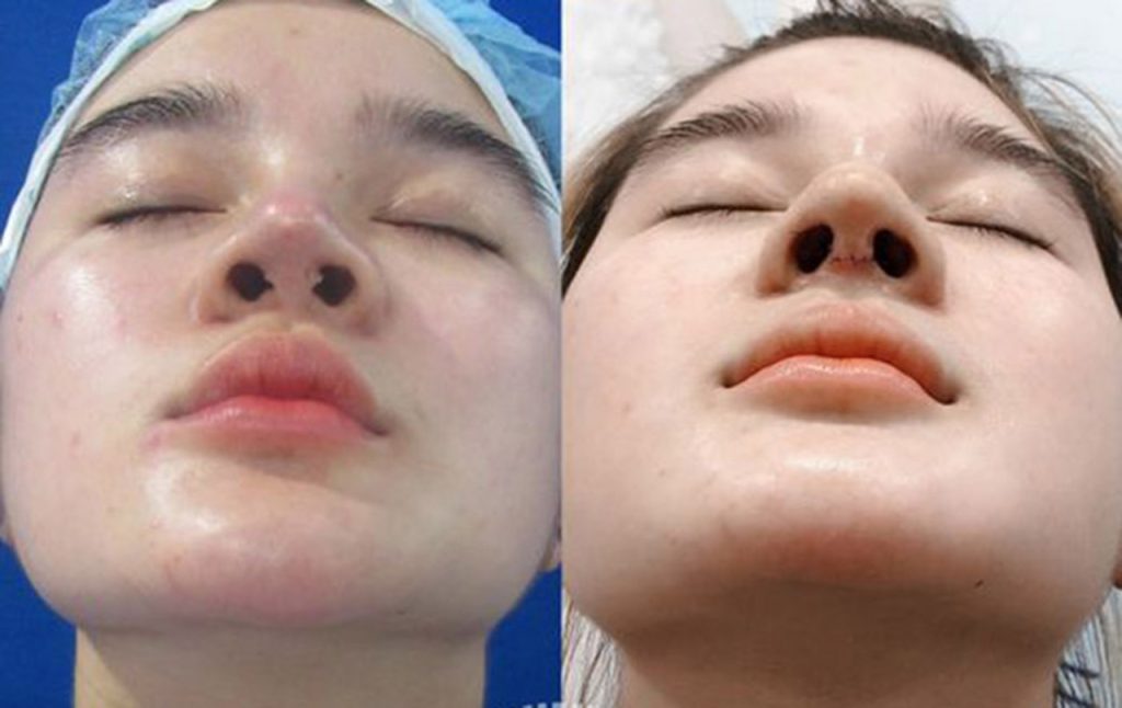 Những màn thay đổi nhan sắc ấn tượng nhờ bàn tay Dr.Lucas Hoàng