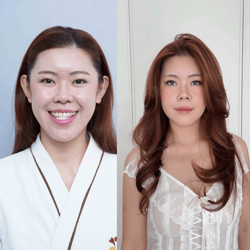 Diện mạo mới của Tiktoker Phạm Phương Anh sau chỉnh hàm móm 2 tháng