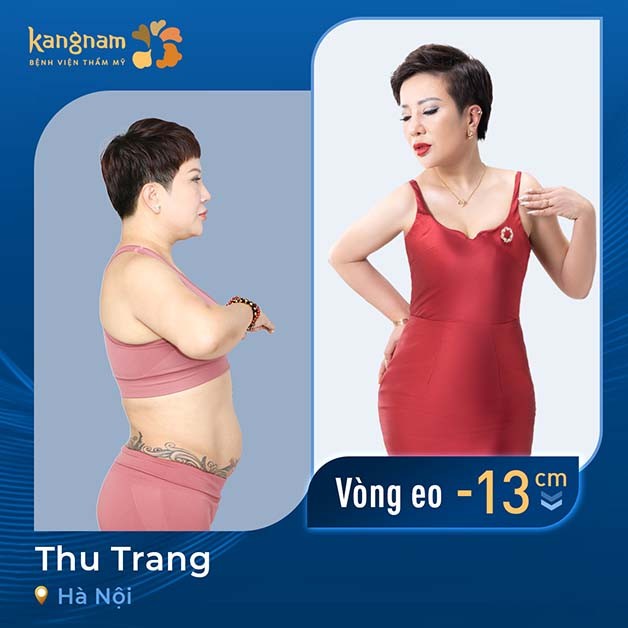 Khách hàng Thu Trang tự tin với body quyến rũ sau khi giảm mỡ bụng tại Kangnam