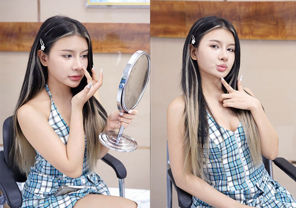 Thực hư hot tiktoker Xuân Ca trùng tu nhan sắc tại BVTM Kangnam?