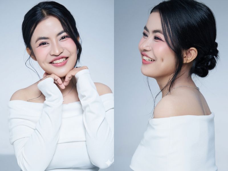 Kết quả sau khi cấy mỡ mặt của Trương Thị Trà My tại Bệnh viện Thẩm mỹ Kangnam. Gương mặt đã trở nên đầy đặn, trẻ trung và rạng rỡ hơn hẳn. Các vùng hốc hác đã được làm đầy tự nhiên, tổng thể khuôn mặt cân đối, nếp mí mắt đều đẹp, giúp nụ cười tự tin và rạng rỡ.