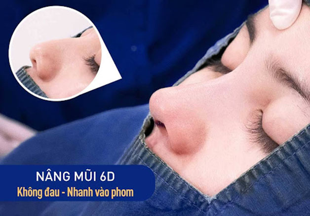 Nâng mũi 6D không đau, nhanh hồi phục