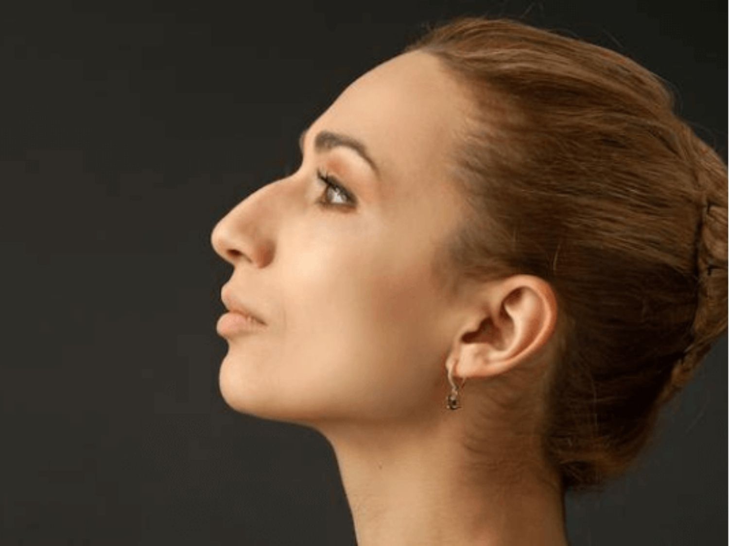 Mũi khoằm khiến gương mặt người phụ nữ trở nên thiếu dịu dàng