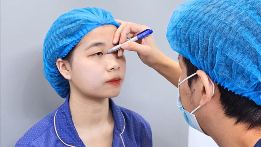 Danh sách bác sĩ cắt mí mắt uy tín tại TP.HCM