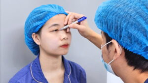 Danh sách bác sĩ cắt mí mắt uy tín tại TP.HCM