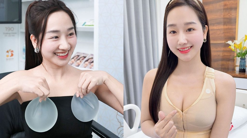 Cô giáo Hà Duyên gợi cảm sau nâng ngực, phá vỡ mọi định kiến