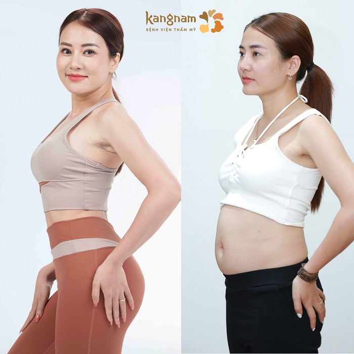 Vóc dáng thon gọn cân đối với dịch vụ thẩm mỹ chất lượng cao