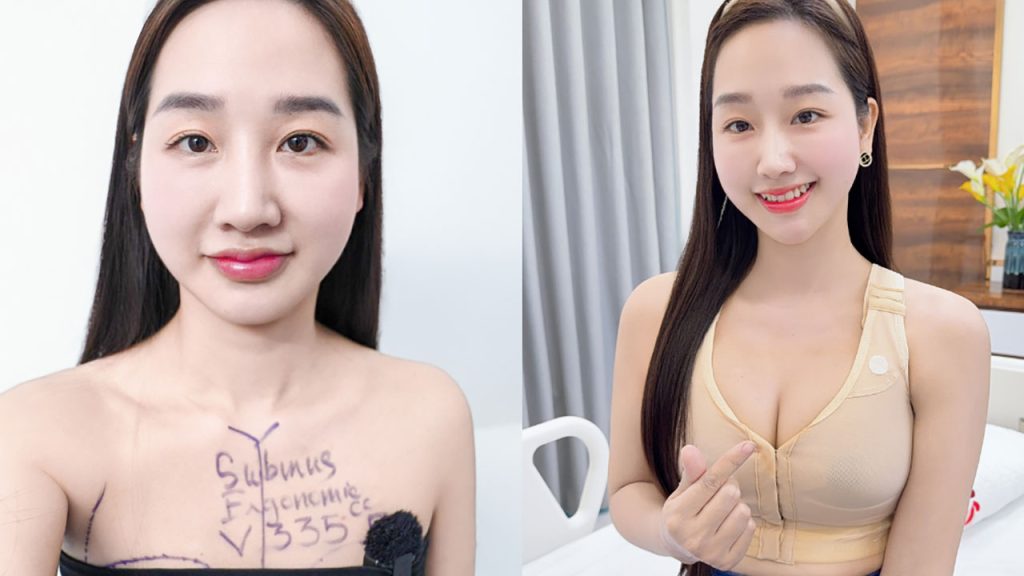 Cô giáo triệu view Hà Duyên gây sốt với vòng 1 cực phẩm hậu nâng ngực