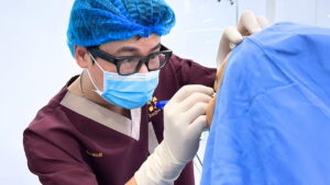 Lấy mỡ bọng mắt ở đâu tốt? Top 5 địa chỉ lấy mỡ mí mắt uy tín