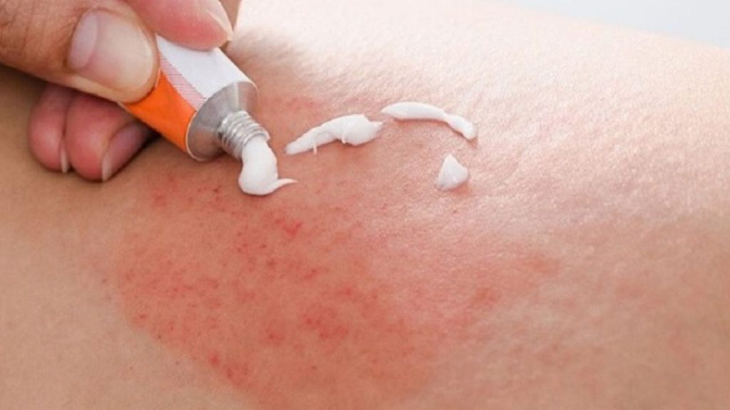 Tác hại của triệt lông vĩnh viễn ít ai để ý tới