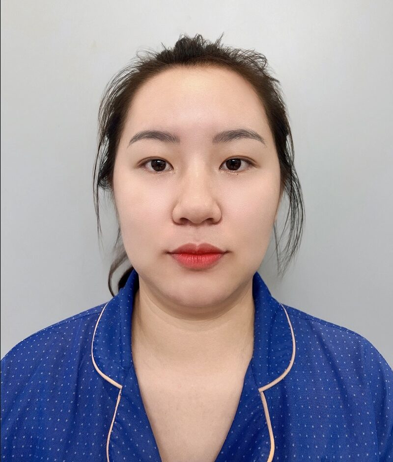 Thanh Hiền sở hữu đôi mắt mí lót