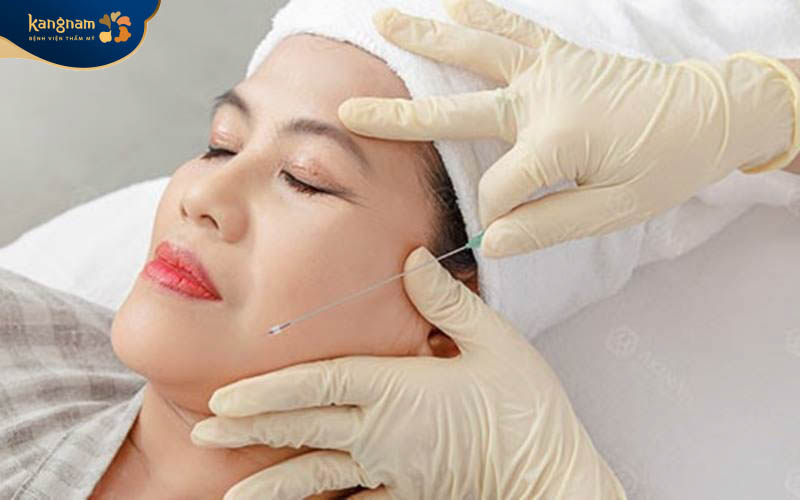 Chi phí cho 1 lần cấy chỉ tùy thuộc vào nhiều yếu tố