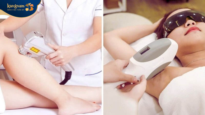 Lựa chọn địa chỉ triệt lông uy tín để tránh những tác hại xảy ra