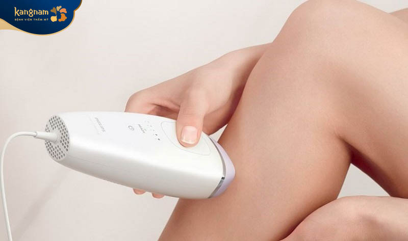 Tự ý triệt lông tại nhà có thể gây nguy hiểm