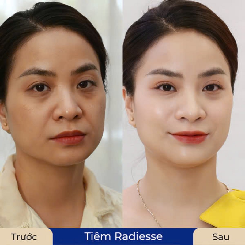 Chăm sóc da chuyên sâu với chi phí phải chăng