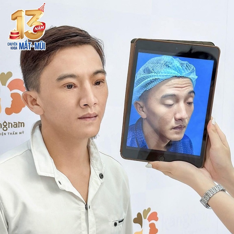 Nâng mũi khắc phục mọi khuyết điểm về dáng mũi