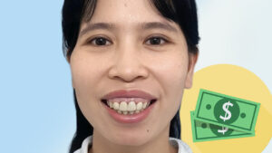 Phẫu thuật hàm hô giá bao nhiêu? Bảng giá cập nhật mới