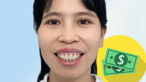 Phẫu thuật hàm hô giá bao nhiêu? Bảng giá cập nhật mới