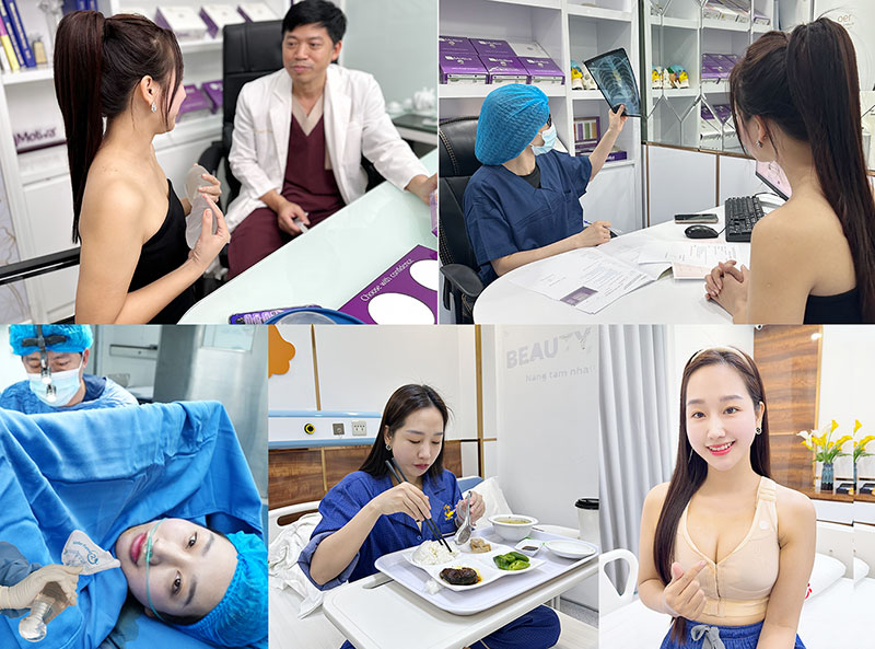 Quá trình nâng ngực được theo dõi bởi bác sĩ chuyên khoa