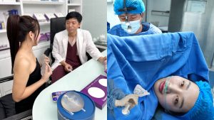 Quy trình Nâng ngực Không chạm – Không khâu da An toàn