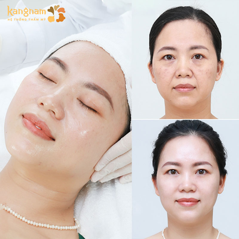 Các dịch vụ thẩm mỹ và chăm sóc Da được ưa chuộng