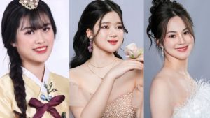 3 cô gái lột xác ngoạn mục nhờ phẫu thuật Hàm mặt