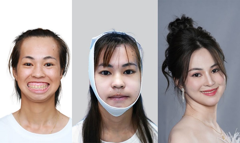 Thí sinh Kim Phượng - Hành trình Lột xác 7